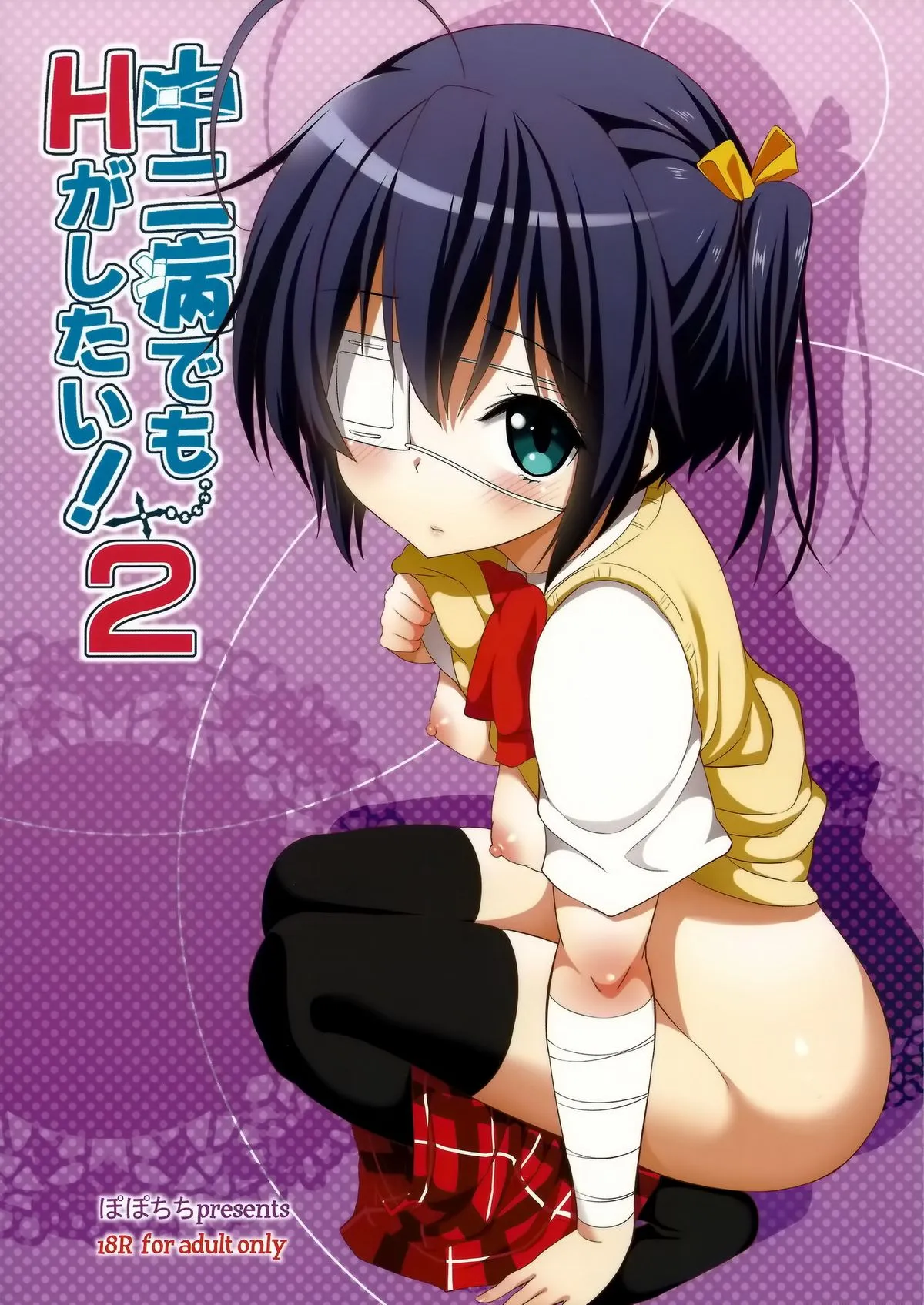 HentaiVN.net - Ảnh 27 - Chuunibyou Demo H ga Shitai! 2 [中二病でもHがしたい!2 (中二病でも恋がしたい!) [英訳]] - Chap 1